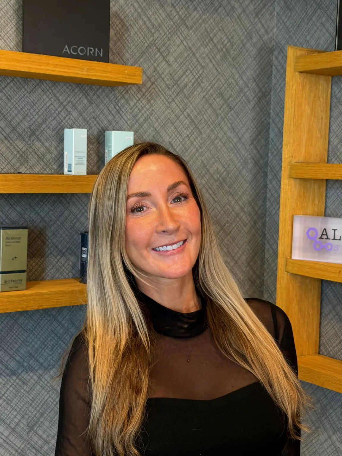 Facelift patient, one year post-op